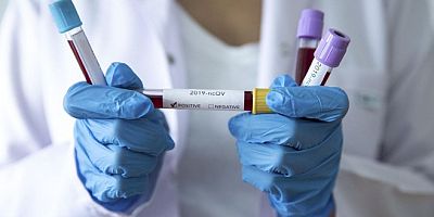 Koronavirüs testi hangi hastanelerde yapılıyor? Sağlık Bakanlığı açıkladı.
