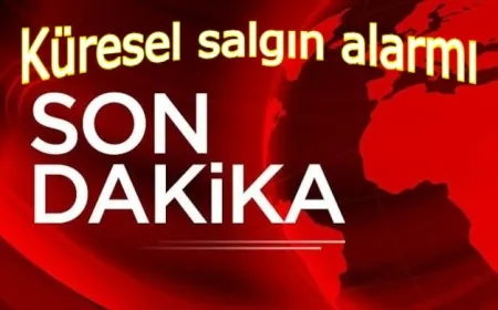 Sağlık Bakanlığı'ndan maymun çiçeği açıklaması: Vaka var mı, kısıtlama gelecek mi?