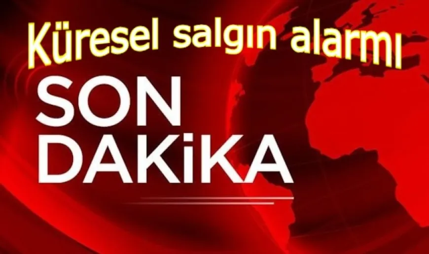Sağlık Bakanlığı'ndan maymun çiçeği açıklaması: Vaka var mı, kısıtlama gelecek mi?