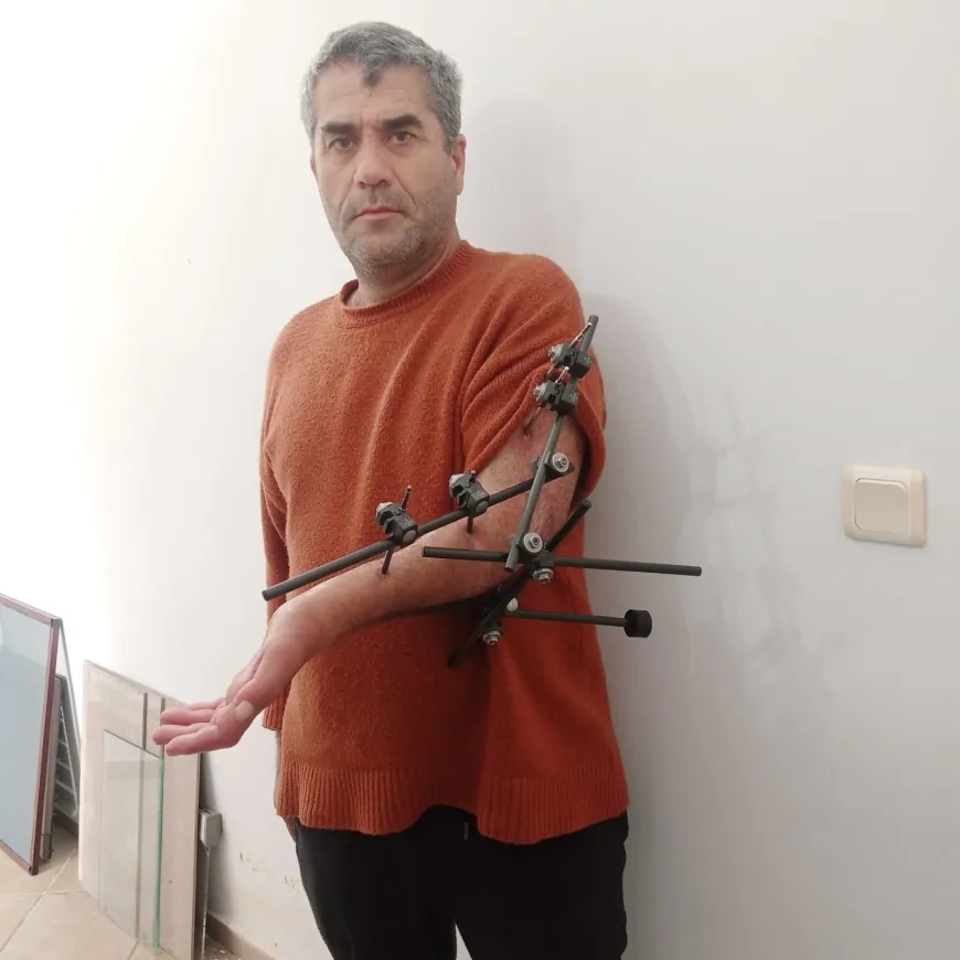 Kazada kopan kolunu kurtardığına sevinemedi
