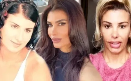 Dişçiye botoks yaptıran türkücü Hatice botokstan zehirlendi!