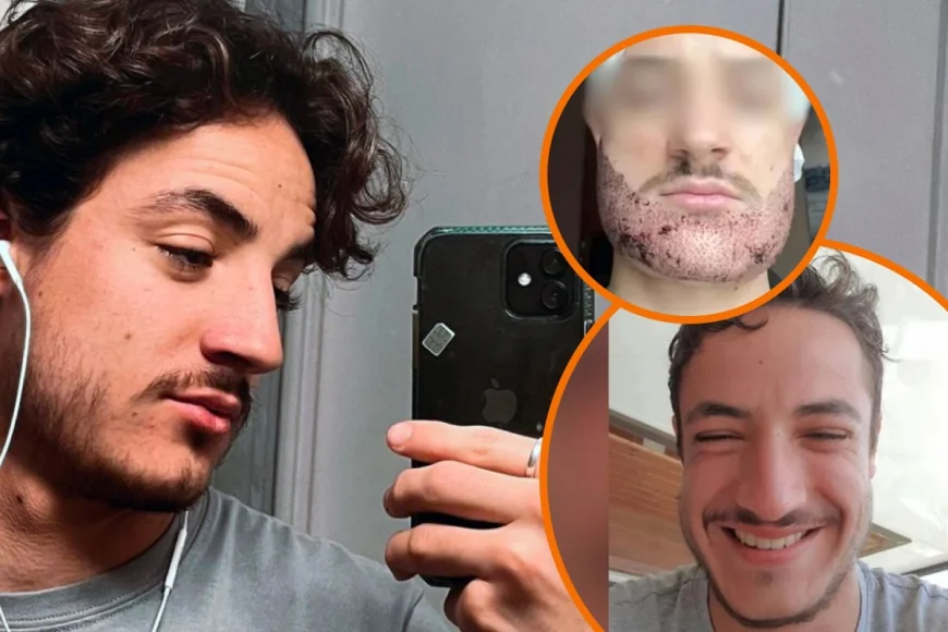 Türkiye’de sakal ekimi yaptırdı, öldü. Operasyonu doktor kılığındaki emlakçı yaptı