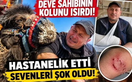 Deve sahibinin kolunu ısırdı hastanelik etti