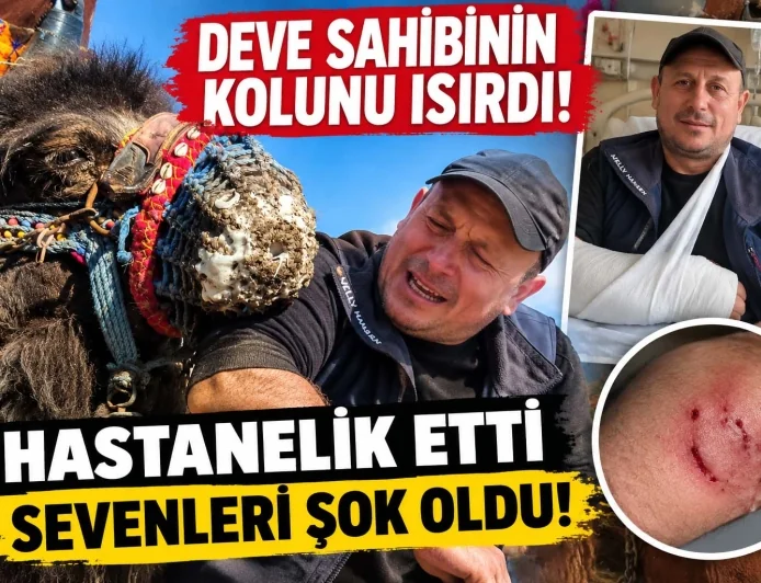 Deve sahibinin kolunu ısırdı hastanelik etti
