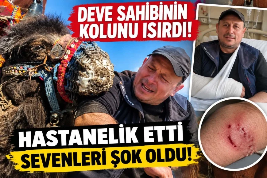 Deve sahibinin kolunu ısırdı hastanelik etti